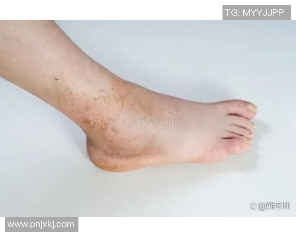 足球明星如何科学保养脚踝的秘诀与实用技巧分享图片展示